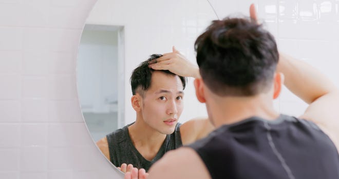 Hair loss can begin in your 20s, here's what you need to do to stop men's hair loss in its tracks.