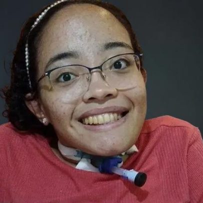 Rafaela enfrenta cirurgia de escoliose em busca de vida normal
