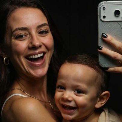 Amanda Araújo mostra transformação estética com harmonização facial e Bumbum Up