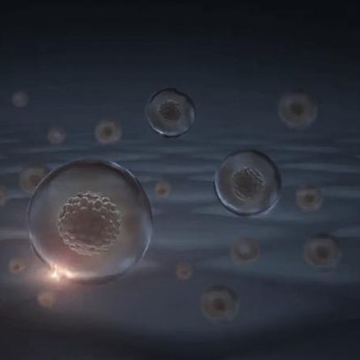 Estudo com células-tronco avança na busca por Huntington nos EUA