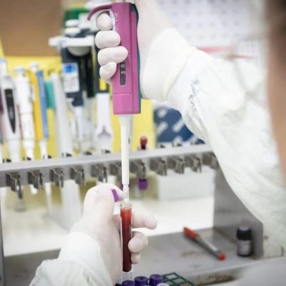 Médicos descartam Ebola em paciente internado no Hospital Emílio Ribas