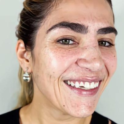 Filha de Leonardo quebra dente após noite romântica e comenta detalhe