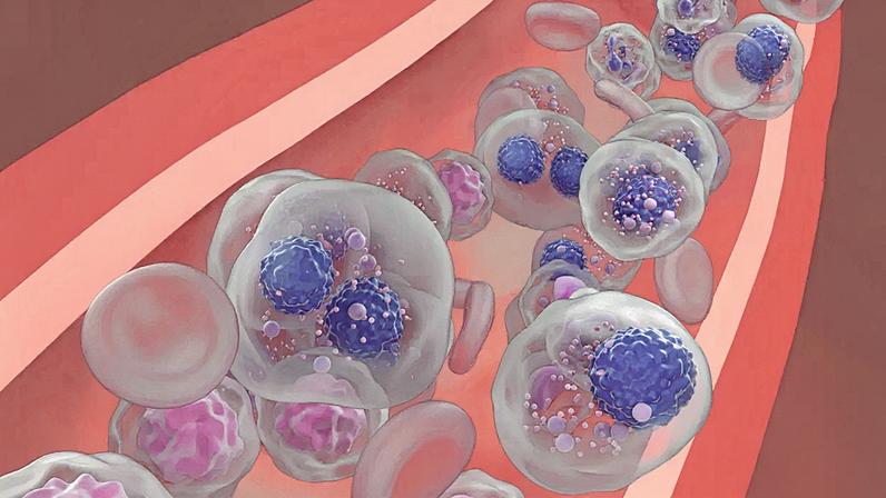 Mieloma múltiplo: células do segundo tipo mais frequente de câncer no sangue (Ilustração: Nemes Laszlo/Getty Images)