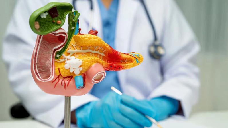 Nos EUA, FDA autorizou o uso do tratamento experimental para câncer de pâncreas por pacientes que preencham alguns critérios.
