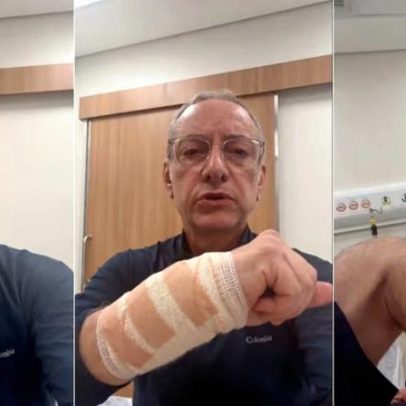 José Roberto Burnier é atacado por pitbull sem guia e critica irresponsabilidade