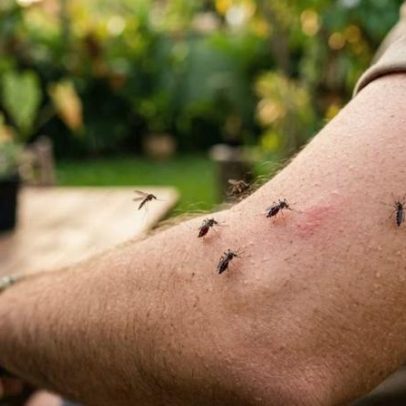 Por que mosquitos escolhem algumas pessoas? O que atrai os pernilongos