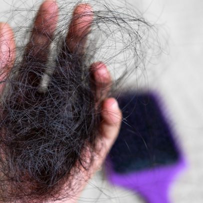 Queda de cabelo ao lavar: diferença entre queda sazonal e alopecia