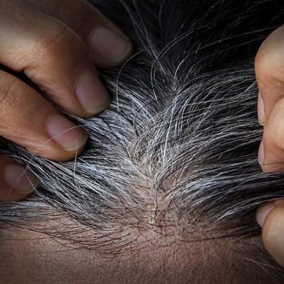 Cabelo branco por estresse: estudo revela se a cor pode voltar