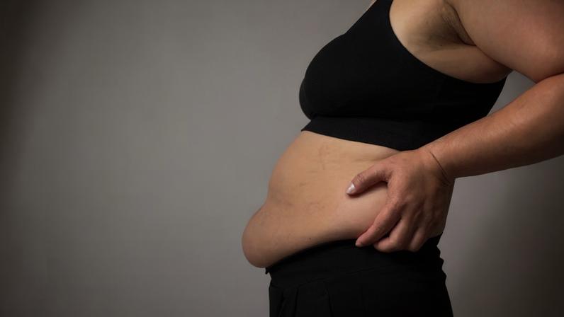 Alguns alimentos podem aumentar o inchaço diário. (Foto: Aflo Images via Canva)