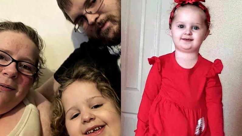 Criança de 3 anos partiu após pais não tratarem piolhos