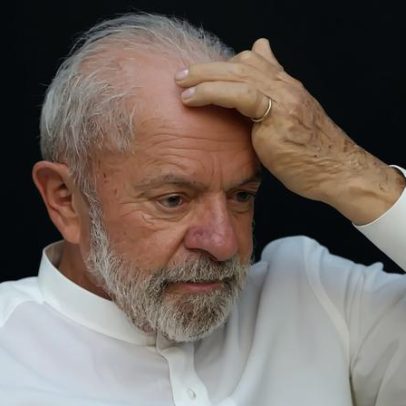 Lula revela diagnóstico de câncer de pele e tratamento para manter boa aparência