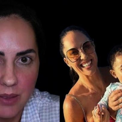 Bebê de Graciele Lacerda passa por cirurgia para remoção de nódulo