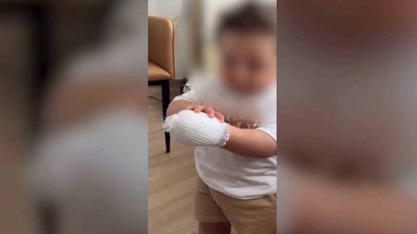 Criança com a mão enfaixada e protegida por uma atadura em ambiente interno