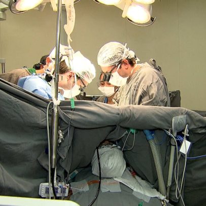 Médico destaca importância da reconstrução mamária para a dignidade das pacientes