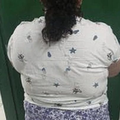 Mulher de 37 anos afirmava ser adolescente por uso de hormônios