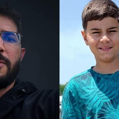 Pai revela 1ª foto do menino após mordida de tubarão