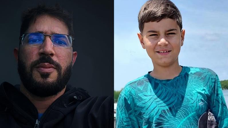 Pai revela 1ª foto do menino após mordida de tubarão