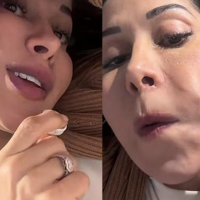 Maíra Cardi desabafa sobre bolotas no rosto 20 anos após procedimento