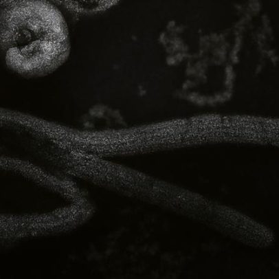 Surto de ebola: qual é a origem do vírus?