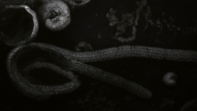 Ebola em seres humanos é causada por mais de uma espécie de vírus