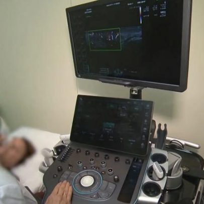 Ultrassom dermatológico pode reduzir complicações do ácido hialurônico