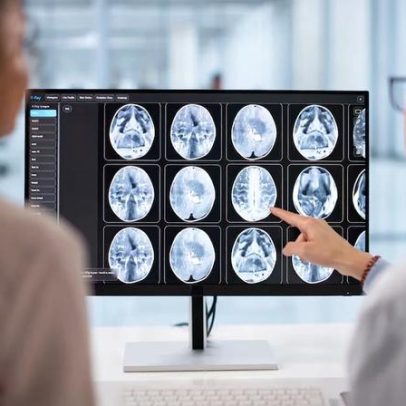 Estudo valida tecnologia brasileira para monitorar pacientes neurocríticos em UTIs