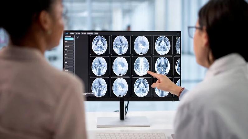 Brasileiros desenvolvem método para monitorar pacientes com lesões cerebrais graves sem recorrer a uma cirurgia