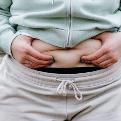 Estresse crônico altera áreas de acúmulo de gordura no corpo