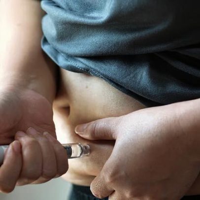 Canetas para tratar obesidade podem influenciar a evolução do câncer