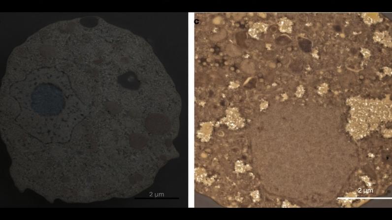 Célula infectada exibe núcleo preservado e ausência de vírions. (Foto: Masaharu Takemura et al. via Journal of Virology)