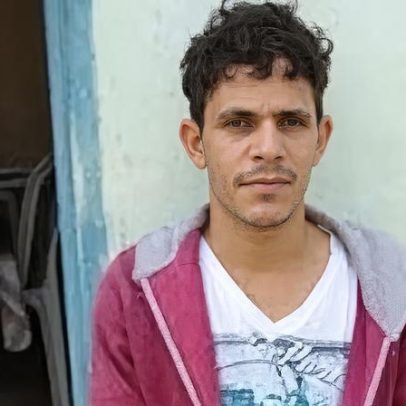 Servidor é condenado por amputar pé para obter seguro milionário na Bahia