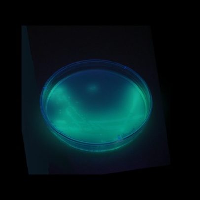 Pseudomonas aeruginosa detectada em água Crystal e em produtos Ypê