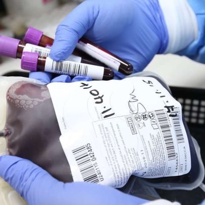 Junho Vermelho: requisitos para doar sangue