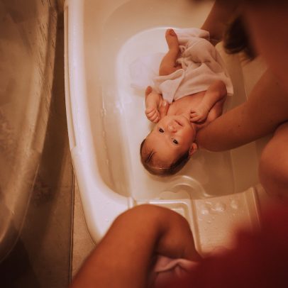 Dermatologistas pedem parar 7 hábitos de higiene do bebê