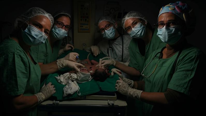 os gêmeos siameses Bernardo e Eduardo nasceram no dia 28 de maio, no Hospital Estadual da Mulher (HEMU), em Goiânia, unidos pela região abdominal e compartilhando o fígado