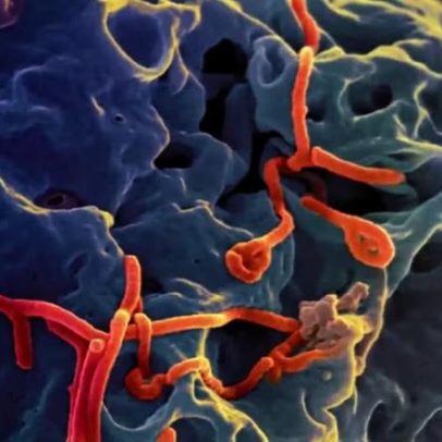 EUA retomam engajamento com Gavi diante de surto de ebola
