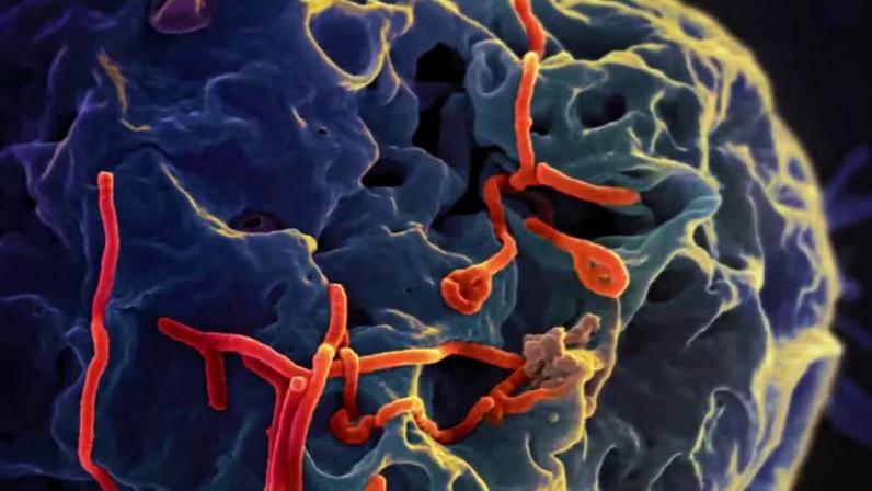 Vírus do ebola (em vermelho) infectando uma célula — Foto: NIAID