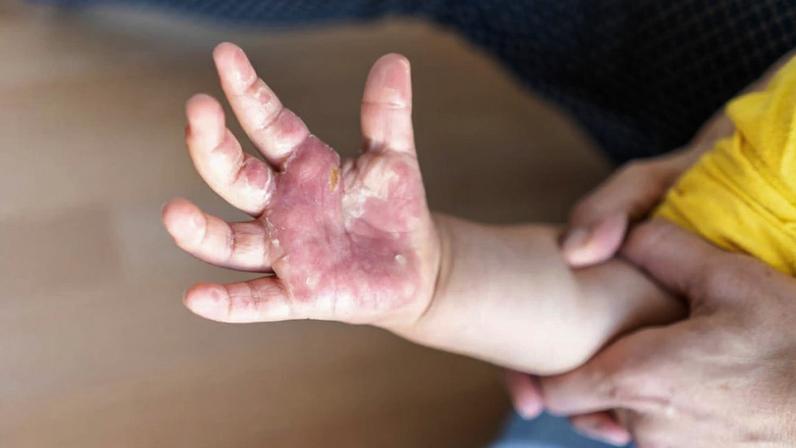 Dados acendem alerta para acidentes que, em muitos casos, poderiam ser evitados com medidas simples de prevenção