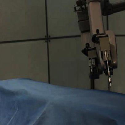 Cirurgia cardíaca sem abrir o tórax: o que a robótica muda na prática