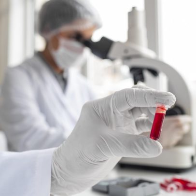 Imunoterapia reduz 71% o risco de mieloma múltiplo em estudo internacional