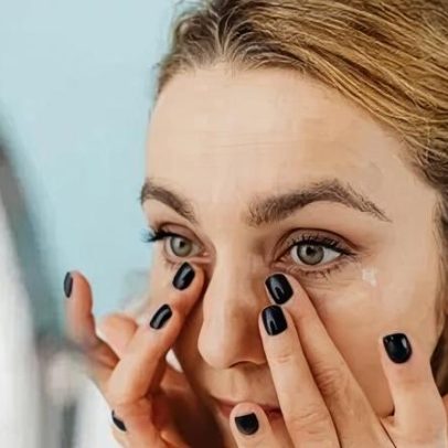 Cuidados naturais para olheiras ao redor dos olhos