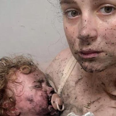 Bebê de 1 ano é intoxicada após morder planta venenosa durante passeio