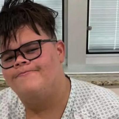 Influenciador Gordão da XJ mostra mudança corporal após perder 130 kg