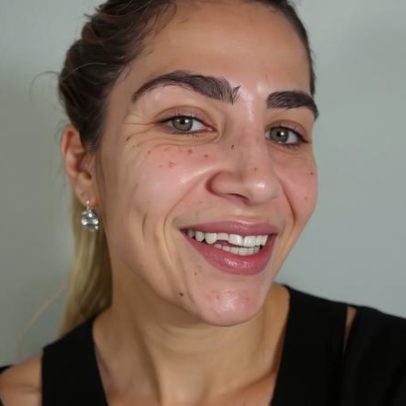 Jéssica Beatriz, filha de Leonardo, exibe sorriso após dentes danificados por tombo