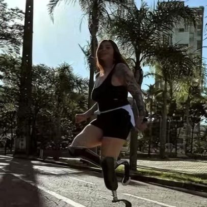Mulher é abandonada pelo namorado após amputação de ambos os pés