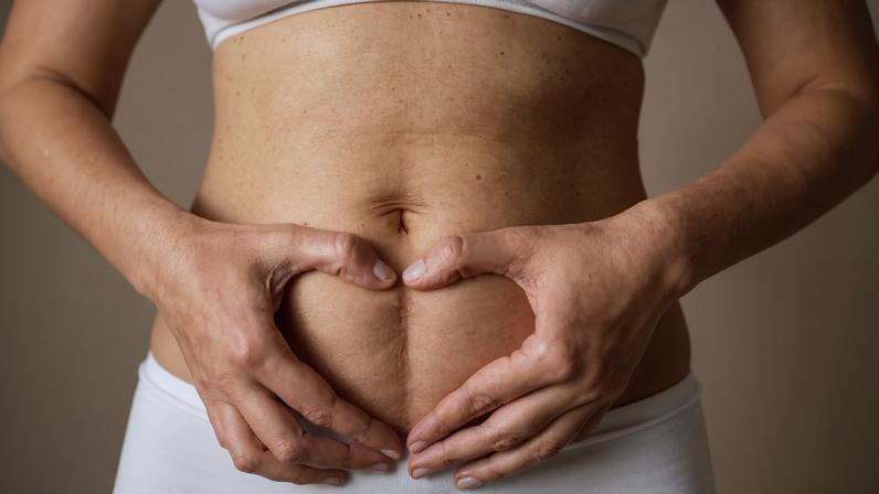 Veja quais são os principais fatores para ocorrer a diástase — Foto: Magnific