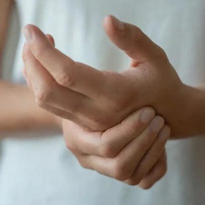 Lúpus é doença conhecida, mas rara, explica especialista à Dr. Kalil