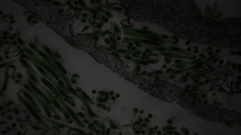 Vírus do Ebola visto no microscópio