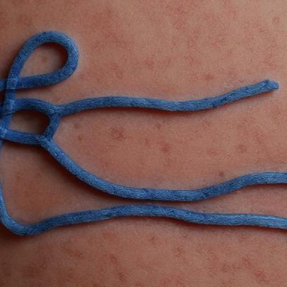 OMS aponta que surto de Ebola no Congo pode ter começado em janeiro