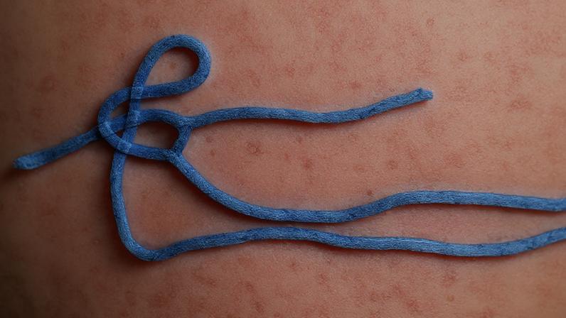 Imagem do vírus do ebola